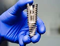Implantes Dentales